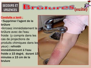 Conduite a tenir :
•Supprimer l'agent de la
brûlure
•Arrosez immédiatement la
brûlure avec de l'eau
froide (y compris dans les
cas de projections de
produits chimiques dans les
yeux) : refroidir
immédiatement à l'eau
froide a 15 degré, durant 15
minutes a 15 cm de la
brulure
 