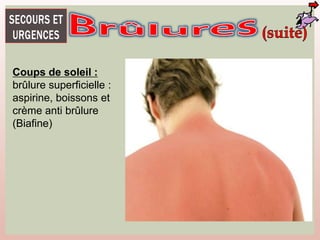 Coups de soleil :
brûlure superficielle :
aspirine, boissons et
crème anti brûlure
(Biafine)
 