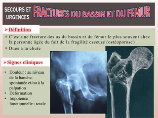 186
 C’est une fracture des os du bassin et du fémur le plus souvent chez
la personne âgée du fait de la fragilité osseuse (ostéoporose)
 Dues à la chute
Définition
Signes cliniques
• Douleur : au niveau
de la hanche,
spontanée et/ou à la
palpation
• Déformation
• Impotence
fonctionnelle : totale
 