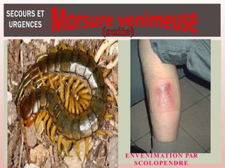 ENVENIMATION PAR
SCOLOPENDRE
 