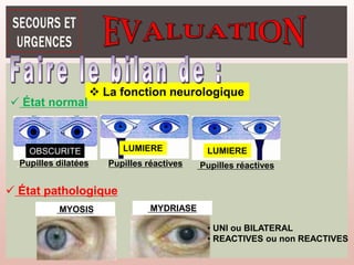  La fonction neurologique
 État normal
OBSCURITE
Pupilles dilatées Pupilles réactives
LUMIERE LUMIERE
Pupilles réactives
 État pathologique
MYDRIASE
MYOSIS
• UNI ou BILATERAL
• REACTIVES ou non REACTIVES
 