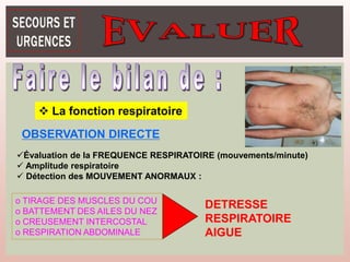 OBSERVATION DIRECTE
Évaluation de la FREQUENCE RESPIRATOIRE (mouvements/minute)
 Amplitude respiratoire
 Détection des MOUVEMENT ANORMAUX :
o TIRAGE DES MUSCLES DU COU
o BATTEMENT DES AILES DU NEZ
o CREUSEMENT INTERCOSTAL
o RESPIRATION ABDOMINALE
DETRESSE
RESPIRATOIRE
AIGUE
 La fonction respiratoire
 