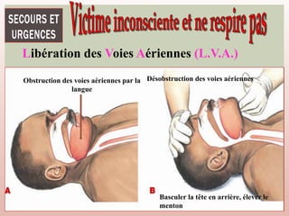 Libération des Voies Aériennes (L.V.A.)
Obstruction des voies aériennes par la
langue
Basculer la tête en arrière, élever le
menton
Désobstruction des voies aériennes
 