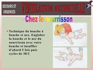  Technique du bouche à
bouche et nez. Englober
la bouche et le nez du
nourrisson avec votre
bouche et insuffler
d’abord 5 fois puis
cycles de 30/2
 