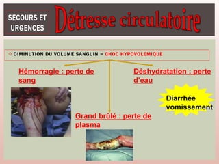 86
 DIMINUTION DU VOLUME SANGUIN = CHOC HYPOVOLEMIQUE
Hémorragie : perte de
sang
Déshydratation : perte
d’eau
Grand brûlé : perte de
plasma
Diarrhée
vomissement
 