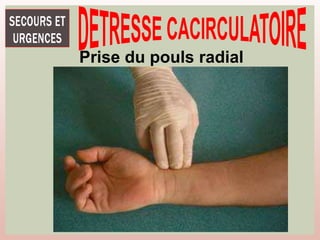 Prise du pouls radial
 
