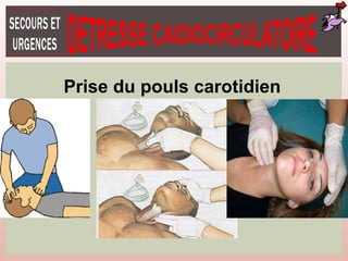 Prise du pouls carotidien
 