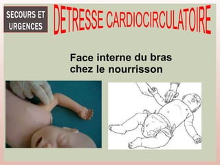 Face
chez
interne du bras
le nourrisson
 