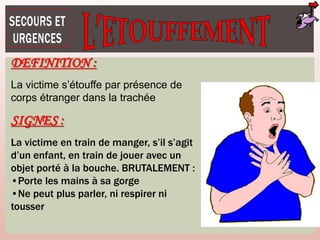 DEFINITION :
La victime s’étouffe par présence de
corps étranger dans la trachée
SIGNES :
La victime en train de manger, s’il s’agit
d’un enfant, en train de jouer avec un
objet porté à la bouche. BRUTALEMENT :
•Porte les mains à sa gorge
•Ne peut plus parler, ni respirer ni
tousser
 