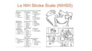 Le NIH Stroke Scale (NIHSS)
 