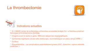 La thrombectomie
Indications actuelles:
* Si > 06H00, échec de la fibrinolyse et thrombus accessible (bridge) OU si thrombus proximal:
fibrinolyse et thrombectomie d'emblée.
* Imagerie avant et après le geste: IRM avec séquences angiographiques.
* Contraintes logistiques (accès salle endoscopie, neuroradiologue sur place, temps d'IRM..).
* Coûteux.
* Risque/bénéfice...car complications potentiellement graves (AVC, dissection, rupture artérielle,
resténose..).
 