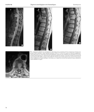 Urgences neurologiques non traumatiques | PDF