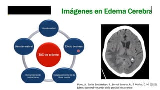 Piano, A., Zurita Santisteban, R., Bernal Basurto, R., & Muñoz, C. M. (2023).
Edema cerebral y manejo de la presión intracraneal
 