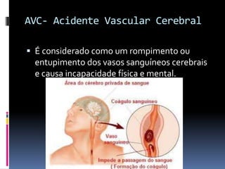 AVC- Acidente Vascular Cerebral
 É considerado como um rompimento ou
entupimento dos vasos sanguíneos cerebrais
e causa incapacidade física e mental.
 