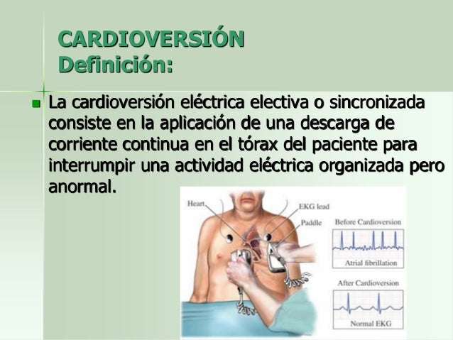 Urgencia Lab 3 Desfibrilación Y Cardioerción