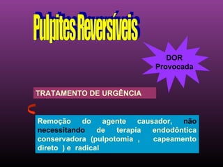 DOR
                            Provocada


TRATAMENTO DE URGÊNCIA


Remoção do agente causador,        não
necessitando     de terapia endodôntica
conservadora (pulpotomia ,  capeamento
direto ) e radical
 