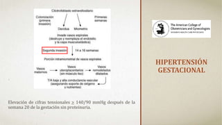 HIPERTENSIÓN
GESTACIONAL
Elevación de cifras tensionales > 140/90 mmHg después de la
semana 20 de la gestación sin proteinuria.
 