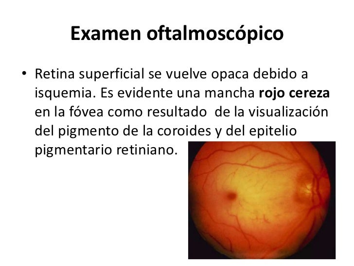 Los componentes que blanquean para la persona