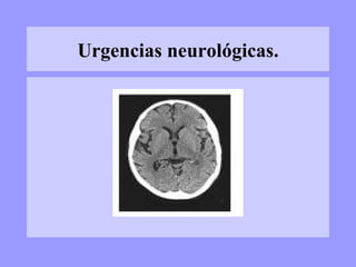 Urgencias neurológicas. 