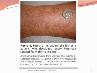 Urgencias Dermatológicas - Dr.H.Martín 10
 