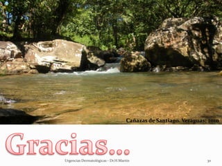Urgencias Dermatológicas - Dr.H.Martín 30
Cañazas de Santiago, Veraguas; 2010
 
