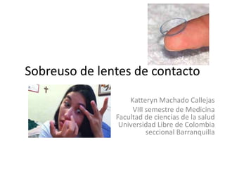 Sobreuso de lentes de contacto
Katteryn Machado Callejas
VIII semestre de Medicina
Facultad de ciencias de la salud
Universidad Libre de Colombia
seccional Barranquilla
 