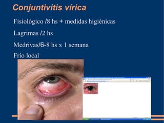 Triquiasis Pomada epitelizante / 8 hs 