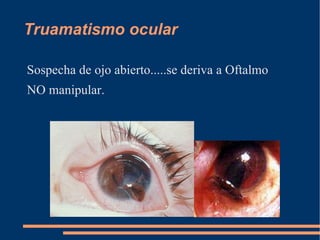 Ojo rojo no doloroso Conjuntivitis alergica 