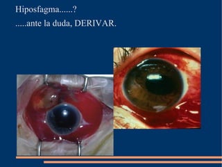 Conjuntivitis viral 