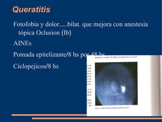 Conjuntivitis alérgica Lubricantes l / 2 hs 