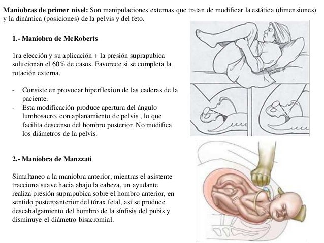 Distocia de Hombros, Hemorragia postparto, Reanimación Cardiopulmonar…