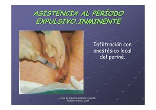 ASISTENCIA AL PERÍODO
 EXPULSIVO.INMINENTE


                                     Infiltración con
                                     anestésico local
                                       del periné.




      Área de Salud de Badajoz. Hospital
            Materno-Infantil. 2008
            Materno-
 