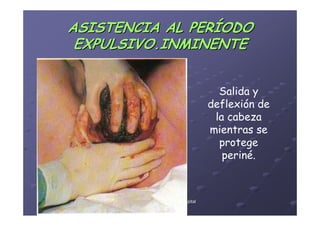 ASISTENCIA AL PERÍODO
 EXPULSIVO.INMINENTE


                                             Salida y
                                           deflexión de
                                            la cabeza
                                           mientras se
                                             protege
                                              periné.



      Área de Salud de Badajoz. Hospital
            Materno-Infantil. 2008
            Materno-
 