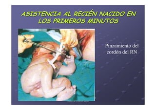 ASISTENCIA AL RECIÉN NACIDO EN
    LOS PRIMEROS MINUTOS


                                               Pinzamiento del
                                                cordón del RN




          Área de Salud de Badajoz. Hospital
                Materno-Infantil. 2008
                Materno-
 