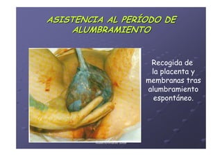ASISTENCIA AL PERÍODO DE
     ALUMBRAMIENTO


                                             Recogida de
                                             la placenta y
                                            membranas tras
                                            alumbramiento
                                              espontáneo.




       Área de Salud de Badajoz. Hospital
             Materno-Infantil. 2008
             Materno-
 