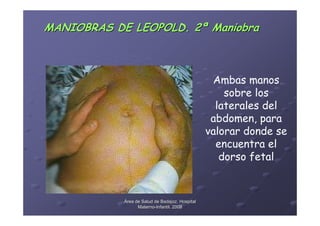 MANIOBRAS DE LEOPOLD. 2ª Maniobra



                                                  Ambas manos
                                                     sobre los
                                                   laterales del
                                                  abdomen, para
                                                 valorar donde se
                                                   encuentra el
                                                    dorso fetal



            Área de Salud de Badajoz. Hospital
                  Materno-Infantil. 2008
                  Materno-
 