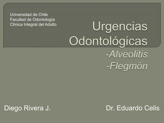 Diego Rivera J. Dr. Eduardo Celis
Universidad de Chile
Facultad de Odontología
Clínica Integral del Adulto
 