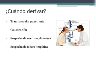 ¿Cuándo derivar?
•   Trauma ocular penetrante

•   Causticación

•   Sospecha de uveítis o glaucoma

•   Sospecha de úlcera herpética
 