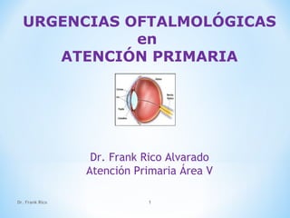 URGENCIAS OFTALMOLÓGICAS
en
ATENCIÓN PRIMARIA
Dr. Frank Rico Alvarado
Atención Primaria Área V
Dr. Frank Rico 1
 