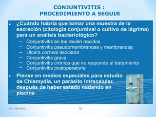 Dr. Frank Rico 20
CONJUNTIVITIS :
PROCEDIMIENTO A SEGUIR
 