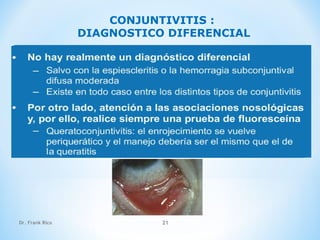 Dr. Frank Rico 21
CONJUNTIVITIS :
DIAGNOSTICO DIFERENCIAL
 
