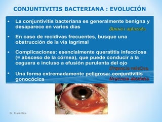 Dr. Frank Rico 27
CONJUNTIVITIS BACTERIANA : EVOLUCIÓN
 