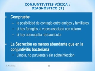 Dr. Frank Rico 32
CONJUNTIVITIS VÍRICA :
DIAGNÓSTICO (1)
 