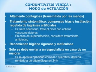 Dr. Frank Rico 35
CONJUNTIVITIS VÍRICA :
MODO de ACTUACIÓN
 