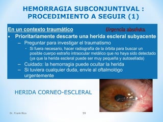 Dr. Frank Rico 59
HEMORRAGIA SUBCONJUNTIVAL :
PROCEDIMIENTO A SEGUIR (1)
HERIDA CORNEO-ESCLERAL
 