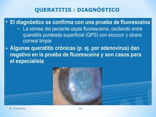 Dr. Frank Rico 69
QUERATITIS : DIAGNÓSTICO
 