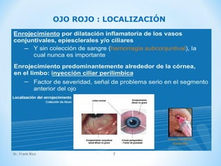 Dr. Frank Rico 7
OJO ROJO : LOCALIZACIÓN
 