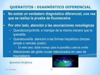 Dr. Frank Rico 71
QUERATITIS : DIAGNÓSTICO DIFERENCIAL
Queratitis herpética
 