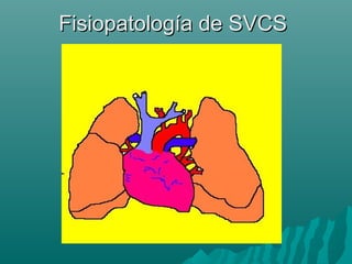 Fisiopatología de SVCSFisiopatología de SVCS
 