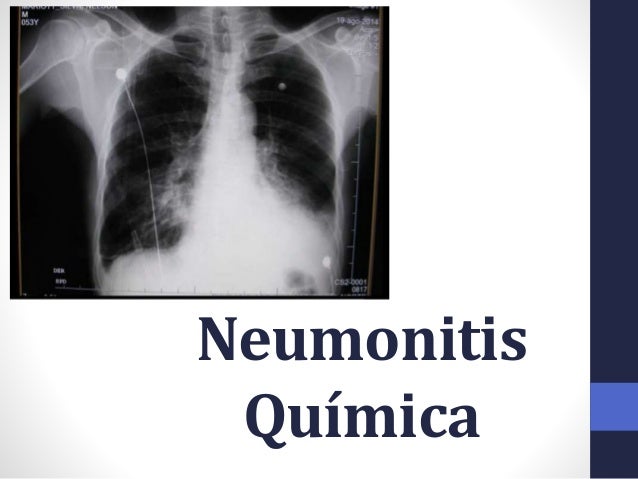 Urgencias Urgencias Respiratorias urgencias-urgencias-respiratorias